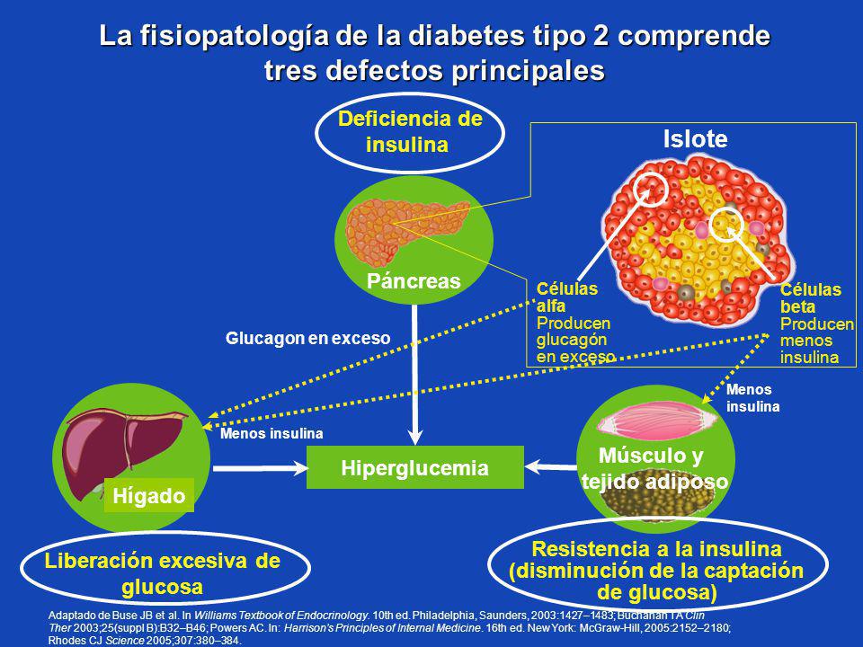 células beta y diabetes tipo 2